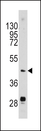 WB - Urokinase (PLAU) Antibody (N-term) AP8161a